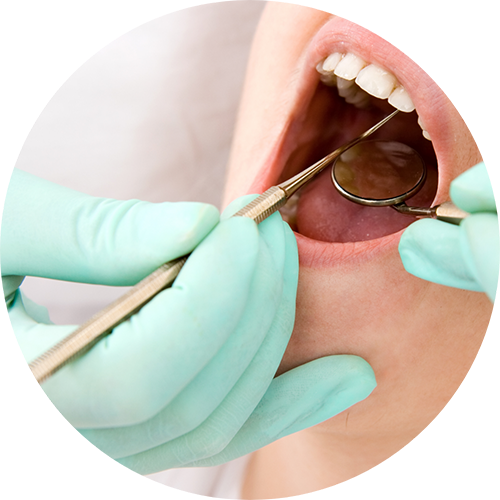 Close up of a person receiving a dental cleaning