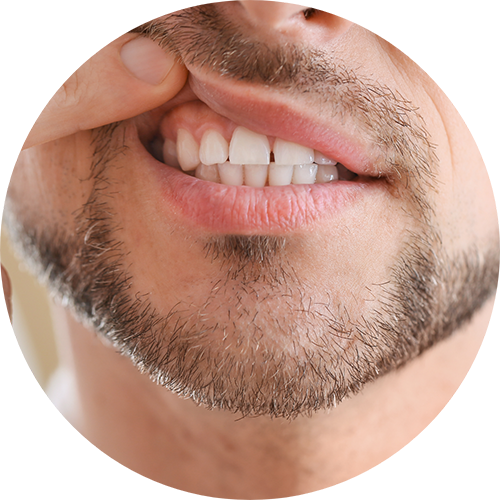 Close up of a man pointing to his gums