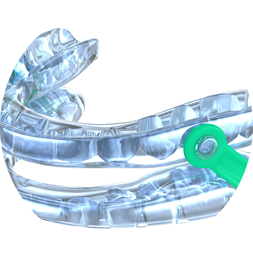 Close-up of a clear mouthguard