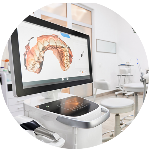 Monitor screen showing a digital impression of a patient's teeth